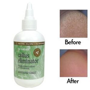 ProLinc Callus Eliminator Solution